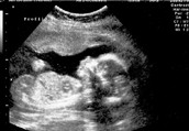Ultrasound Images